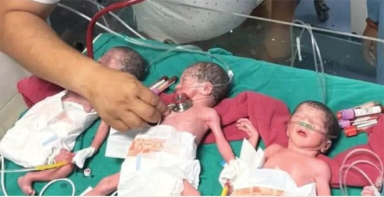 डेढ़ घंटे में हुई ट्रिपलेट डिलीवरी: सतना में सात माह की गर्भवती ने तीन बेटियों को दिया जन्म, तीनों का वजन कम